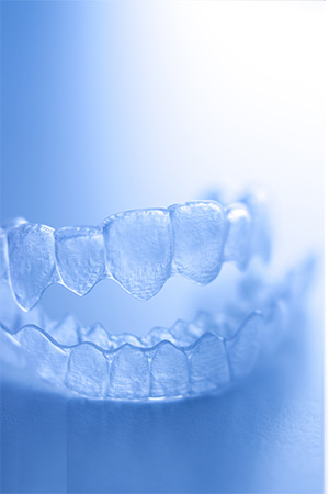 Clear Aligners