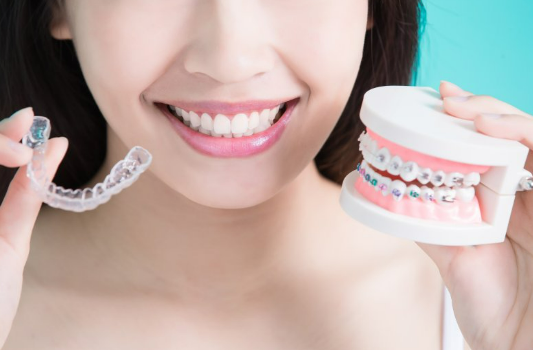 Invisalign