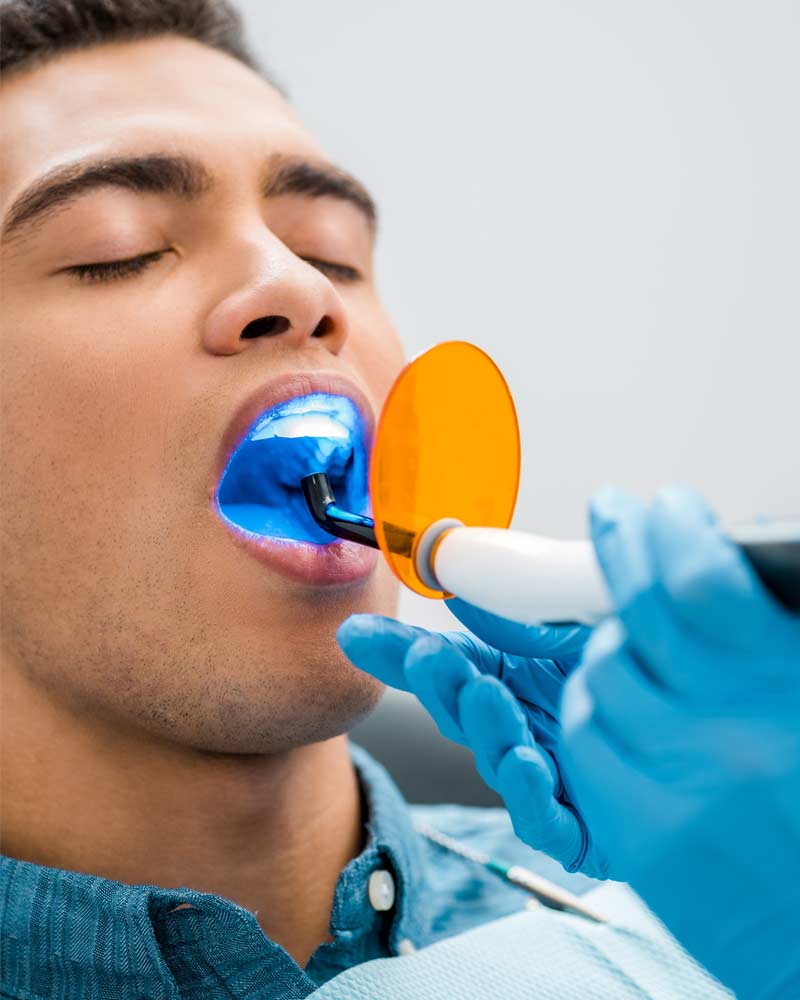 Teeth-Whitening