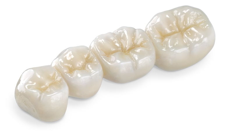 Zirconia Crown