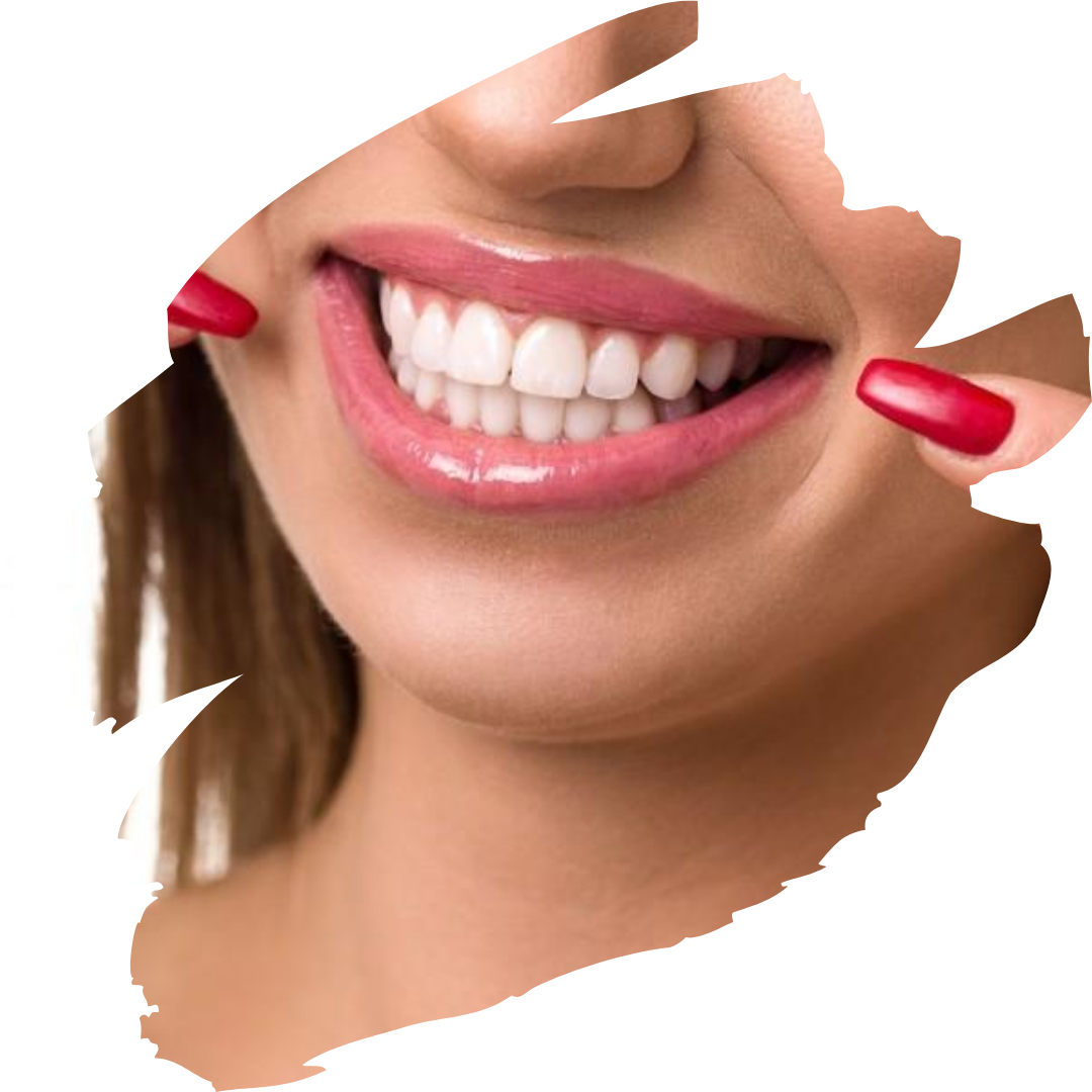 Hollywood Smile
