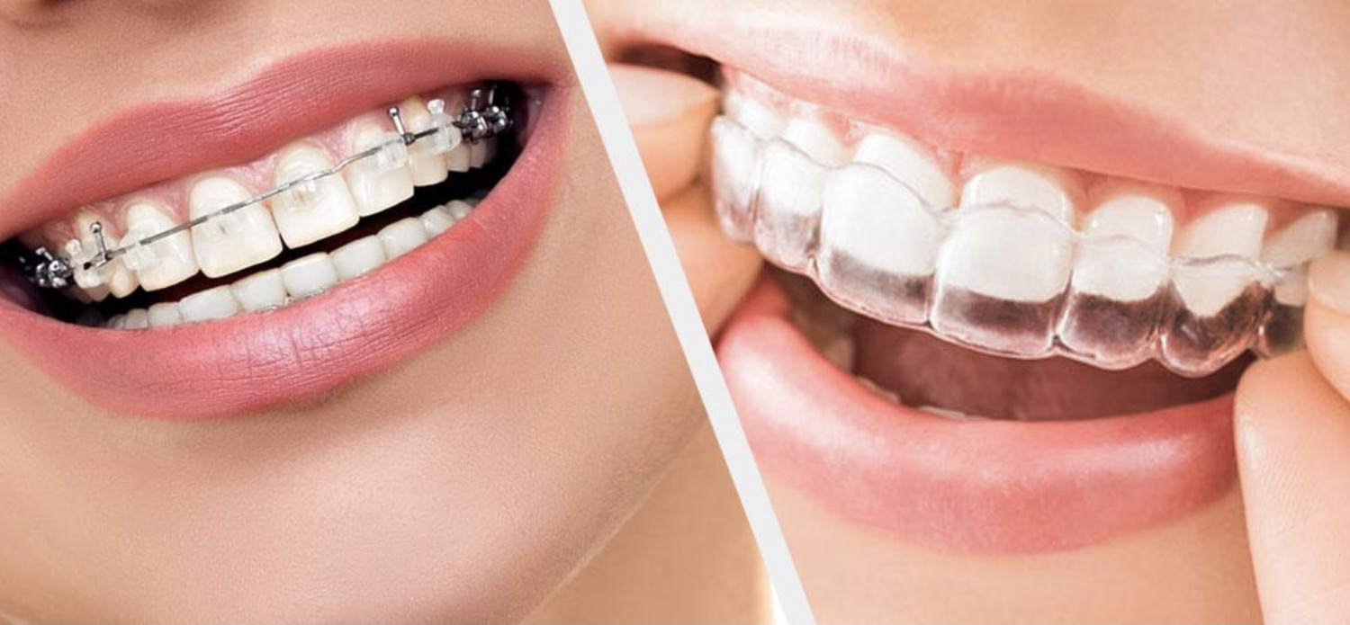 why orthodontics?