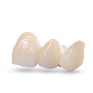 Zirconia Crown image