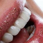 With Every Hollywood Smile